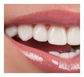 Dental Crowns & Bridges